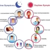 Symptoms of Sleep Apnea
