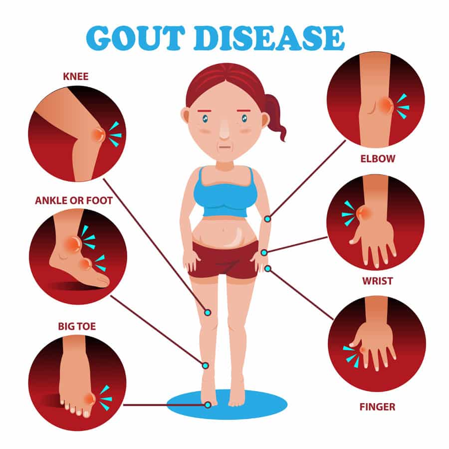 Foods Not To Eat With Gout Problems